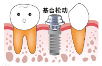 未标题-30.jpg 未标题-30.jpg