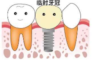 未标题-31.jpg 未标题-31.jpg