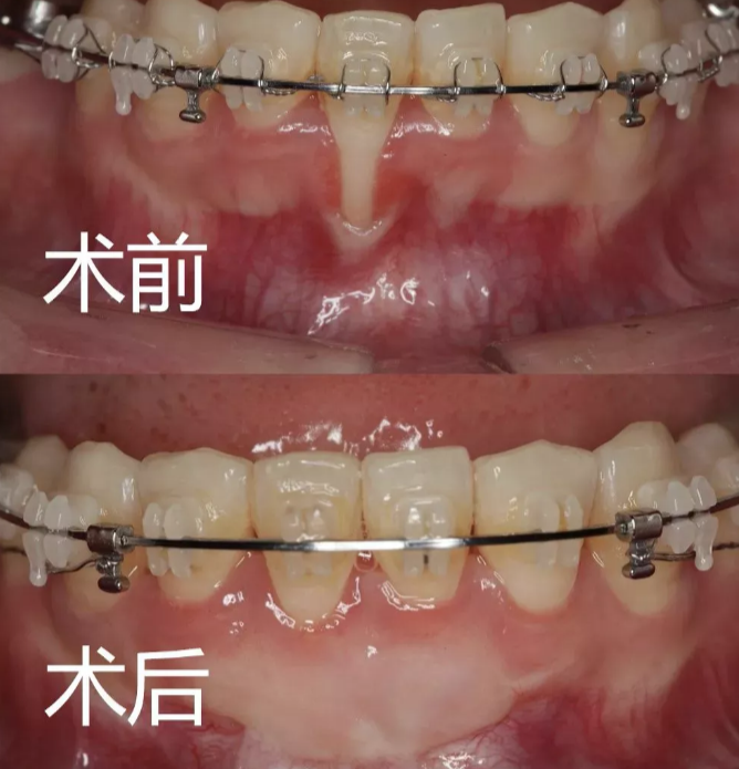 4.png 4.png