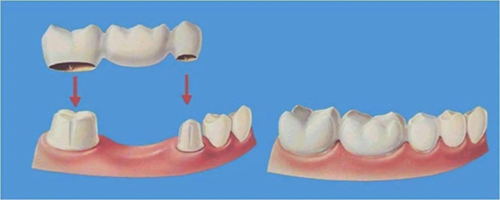 图片5.jpg 图片5.jpg