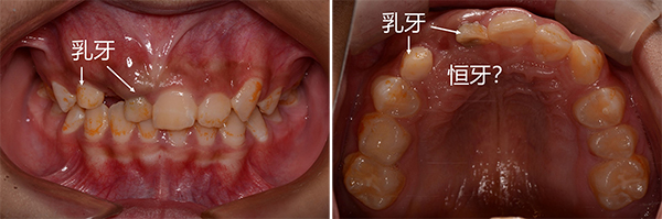 未标题-1.jpg 未标题-1.jpg