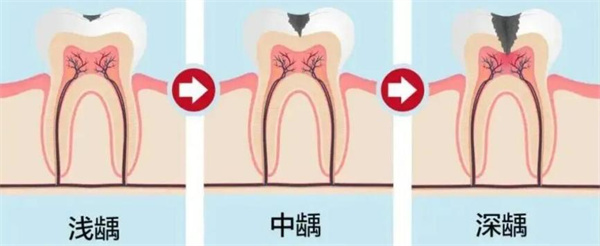图片 31.jpg 图片 31.jpg