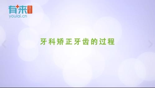 有来医生:矫正牙齿的过程